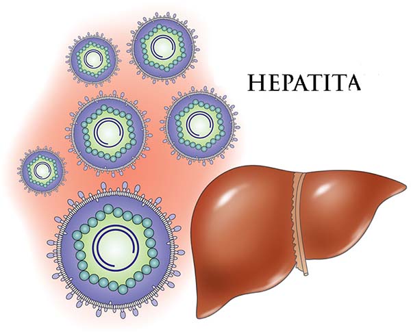 hepatita